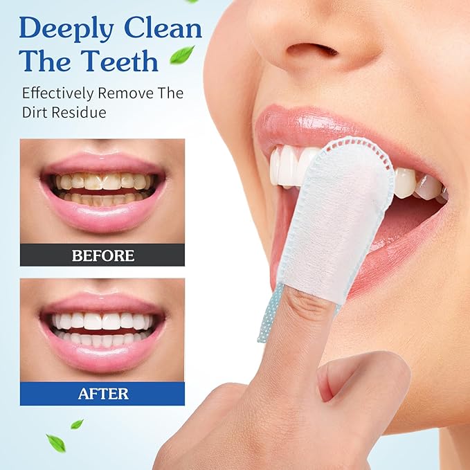 Beavorty Finger Brush Teeth Wipes 50 Pcs Disposable Deep Cleaning Teeth Wipes Deep Teeth Cleaning Finger Oral Wipes for Oral Brush Ups Mini Toothbrush, Individual Package