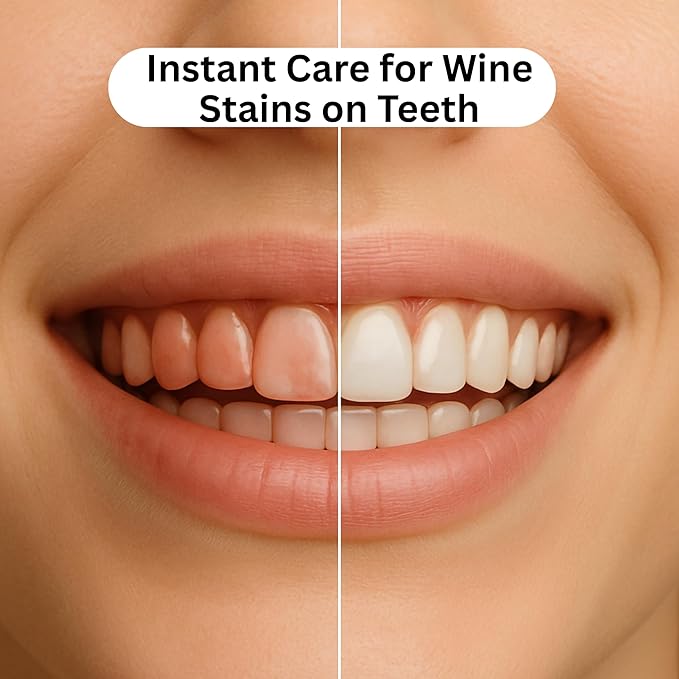 SPRKL Wine Wipes for Teeth – Instant Red Wine Stain Remover, Mint Fresh, 20 Pack Disposable Teeth Wipes