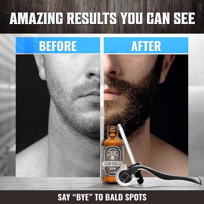 Viking Revolution Beard Growth Kit - 4 Products Included | Advanced Growth Formulation - Balm (2oz), Serum (2fl oz), Derma Roller & Wooden Comb for Beard & Mustache Growth
