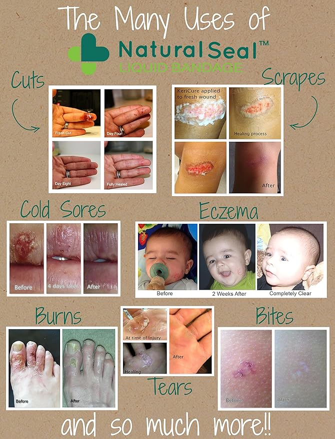 KeriCure's Natural Seal Spray on Bandage with Itch Relief, 1oz First Aid Barrier, Soothing, Protective, Moisturizing Liquid Bandage for Kids, Woman Owned Small Business